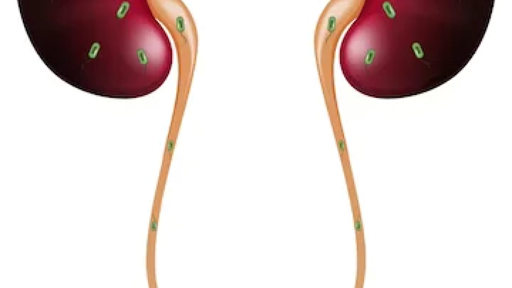مشاكل الكلى